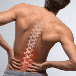 Muscle or Ligament Strain and Back Pain: Causes, Symptoms, and Treatments