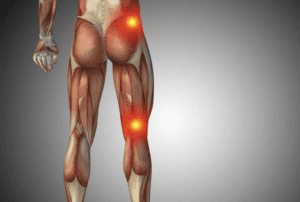 The Role of Leg Strength in Preventing and Alleviating Back Pain