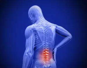 Top Ways to Alleviate Lower Back Pain: Effective Strategies for Relief