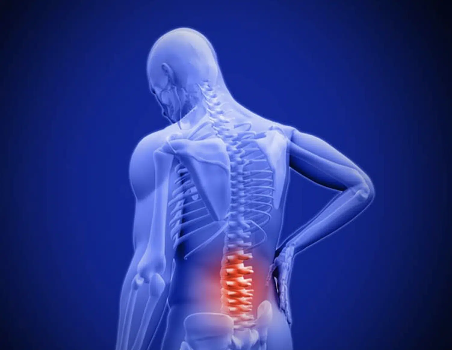 Top Ways to Alleviate Lower Back Pain: Effective Strategies for Relief